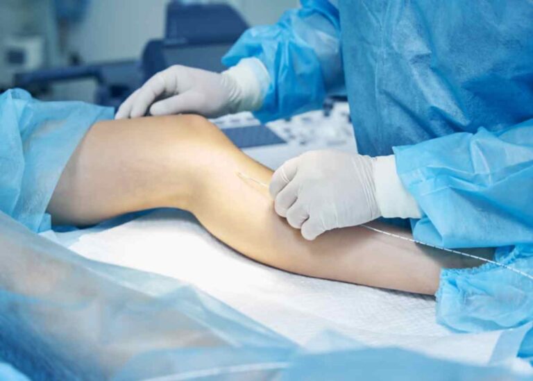 Diz Artroskopisi Nedir ve Neden Tercih Edilir?