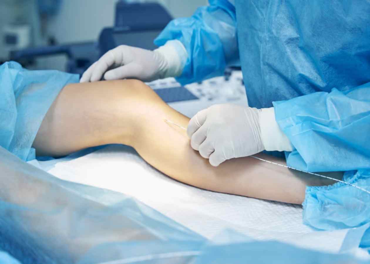 Diz Artroskopisi Nedir ve Neden Tercih Edilir?