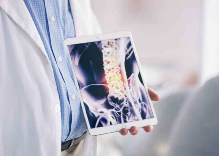 Sinir Sıkışması Tedavisi Hakkında Kapsamlı Rehber