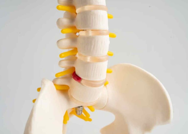 Spinal (Omurilik) Kanal Daralması